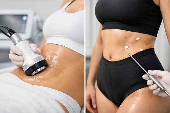 Cavitation Versus Liposuction Results Compared