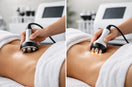 Cavitation vs Radio Frequency for Body Goals