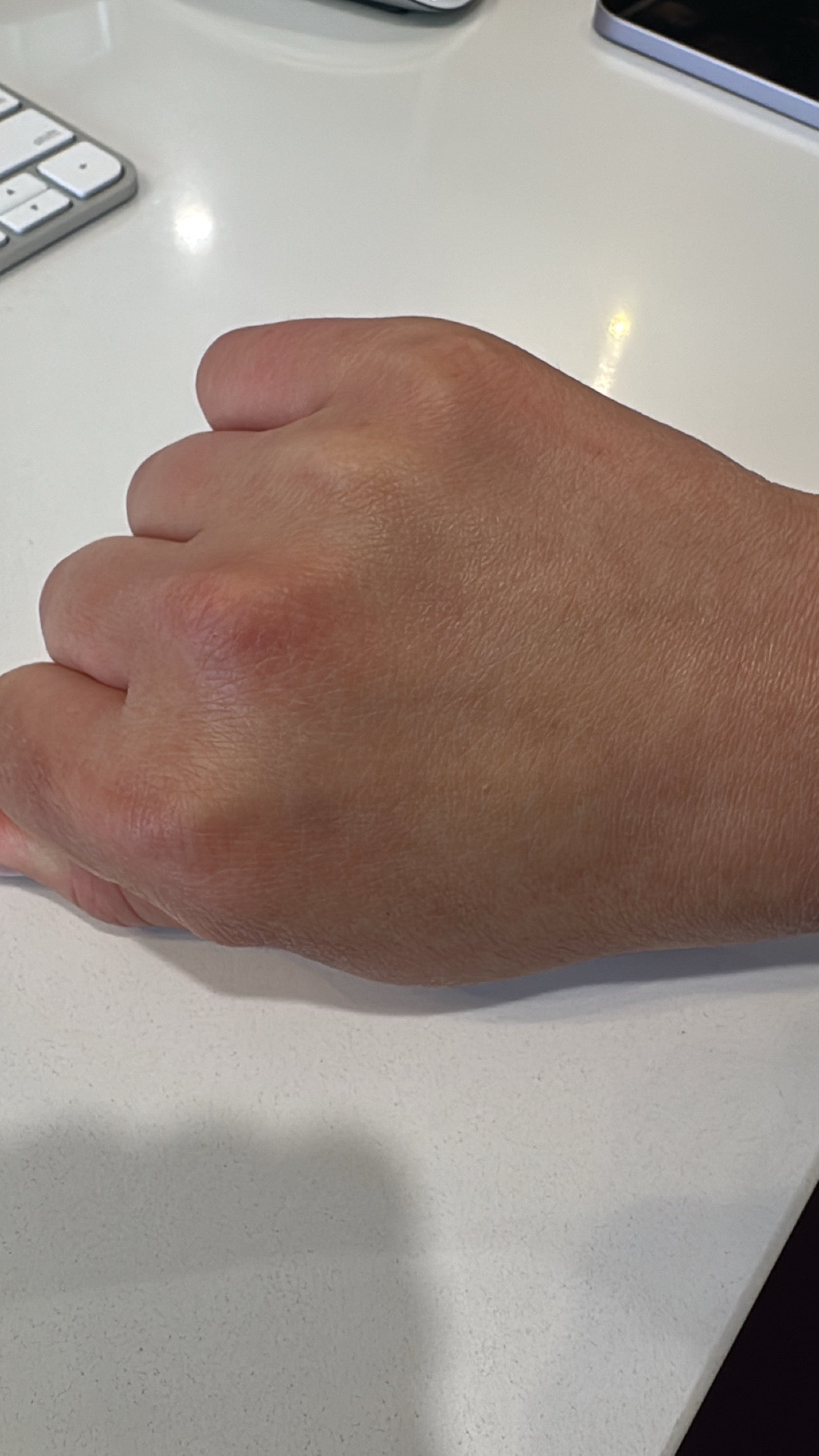After image