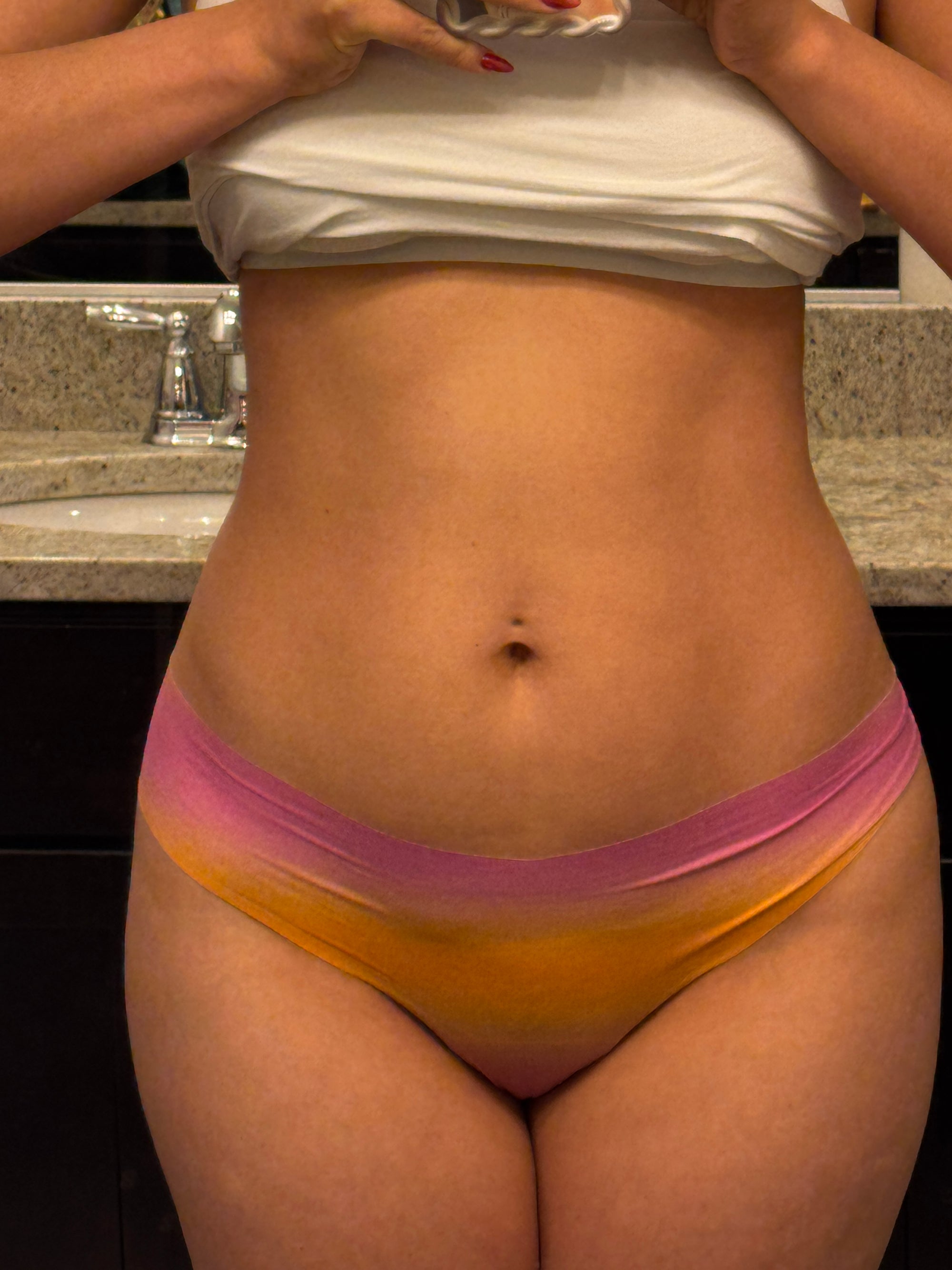 After image