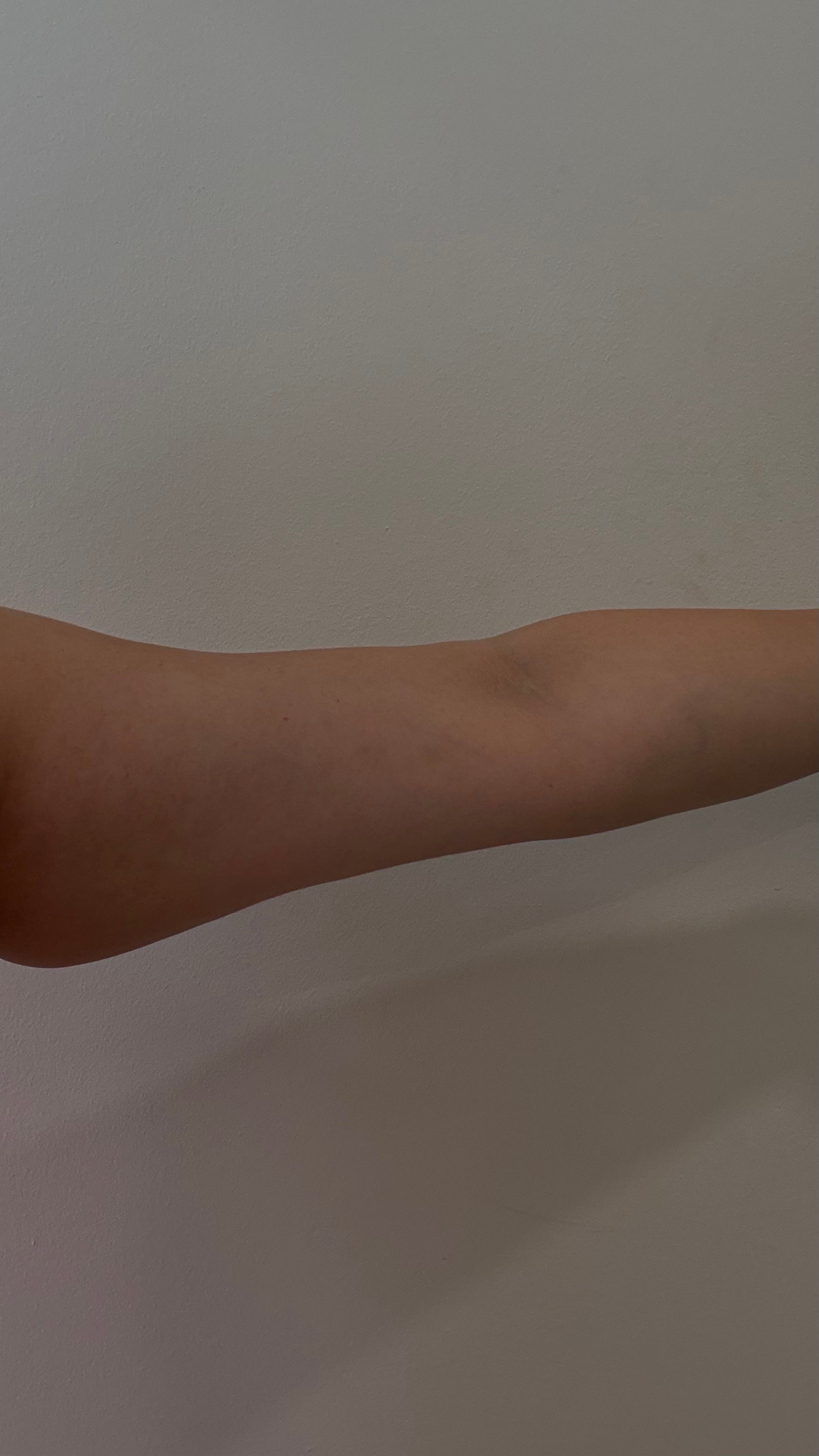 Before and after SculptMe Cream