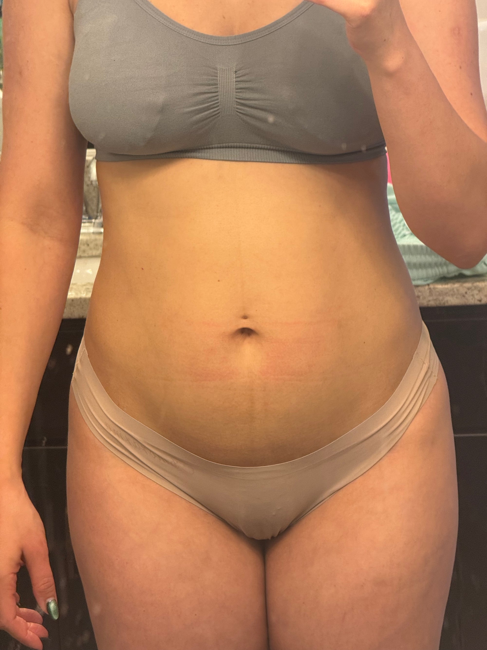 Before image